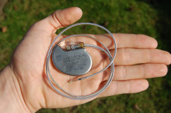 Электрокардиостимулятор при аритмии