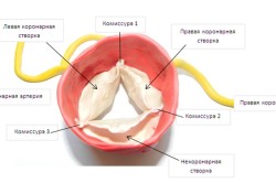 Нормальное строение аортального клапана