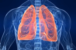 Туберкулез - причина варикоза пищевода