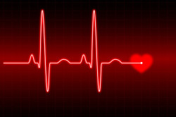 Синдром аритмии - признак ишемической болезни сердца