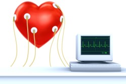 Электрокардиограмма при диагностике инфаркта