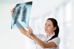 Рентгенологическое обследование сердца