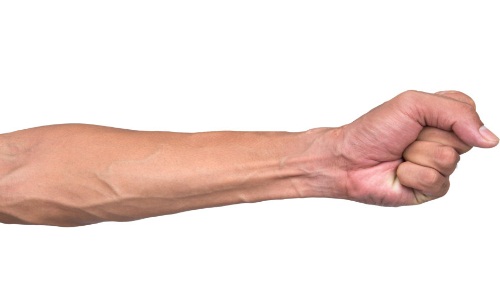 Проблема флебита вены на руке