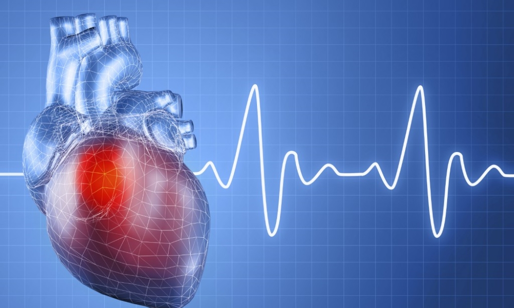 Проблемы аритмии сердца