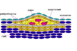 Структура атеросклеротической бляшки
